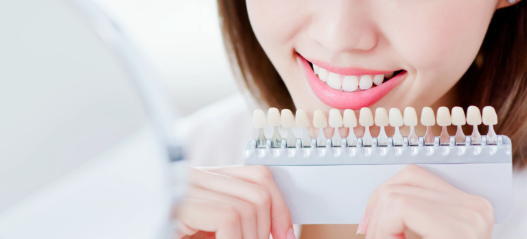 In-Office Teeth Whitening